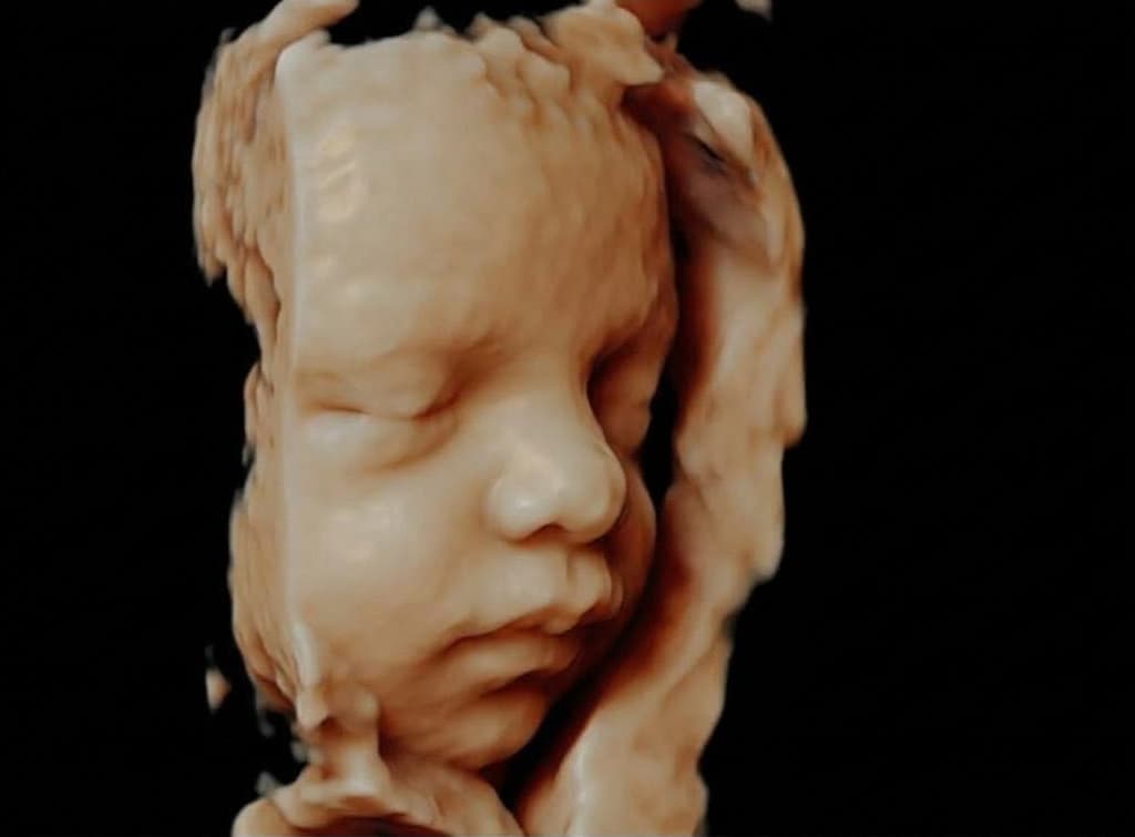 Yüzü hafif yana dönük bebeğin yakın plan üç boyutlu ultrason görüntüsü.